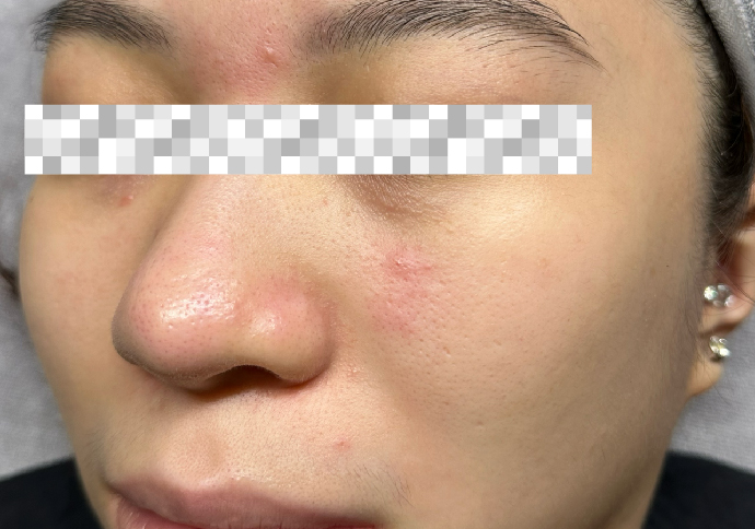 Before